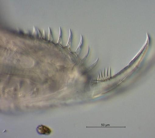image/jpeg an appendage of the zooplankton Ceriodaphnia shows a series of spines along one side of a robust portion, with a very sharp pointed claw extending that has smaller distinctive setae spines at the base. From observation.org Ulrich Drabiniok.